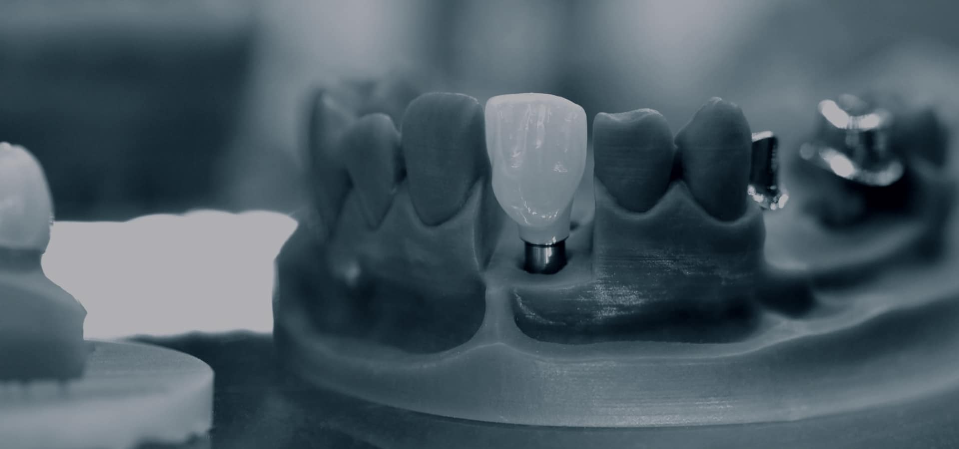 Dental implant models and prosthetics displayed on a professional laboratory tray in grayscale.