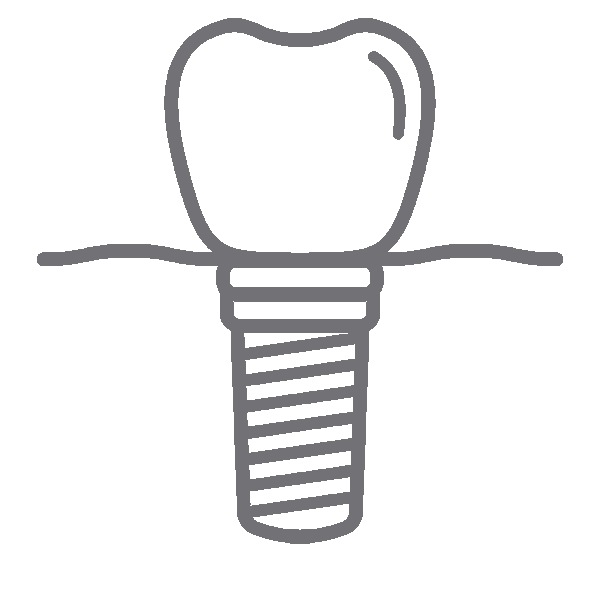 Dental implant diagram showing tooth crown on threaded screw fixture